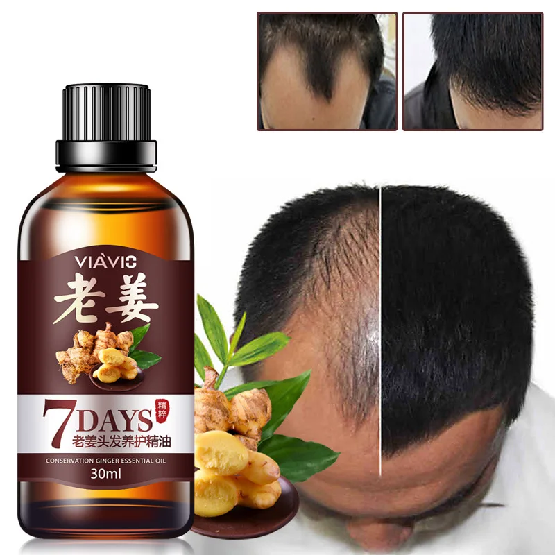 

Hair Massage Growth Serum Essential Oils Ginger Treatment Stop Hair Fall Essence 7 Days Nourishing Soften Scalp Repair Hair Care