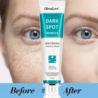 20ml whitening freckle cream face remove dark spots melanin melasma remover brightening skin effective repair anti aging cream
