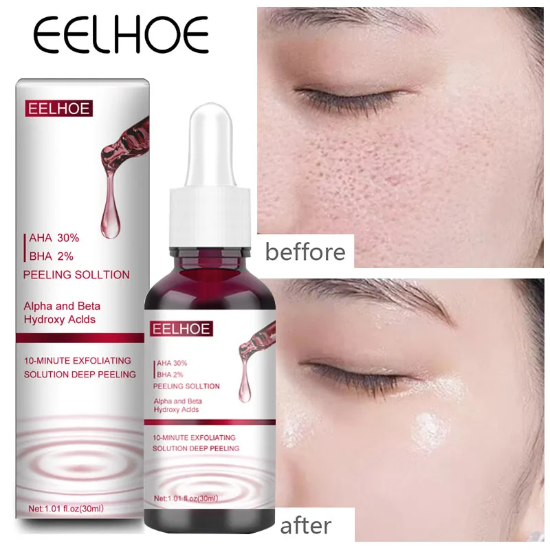 Ácido salicílico encolher poros rosto soro remover cravo acne tratamento esfoliante essência hidratante nutrir reparação cuidados com a pele