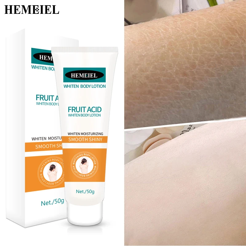 

Fruit Acid Whitening Body Lotion Soften Cutin Bleach Cream Effective Brighten Dark Skin Moisturizing Nourishing Beauty Cosmetics