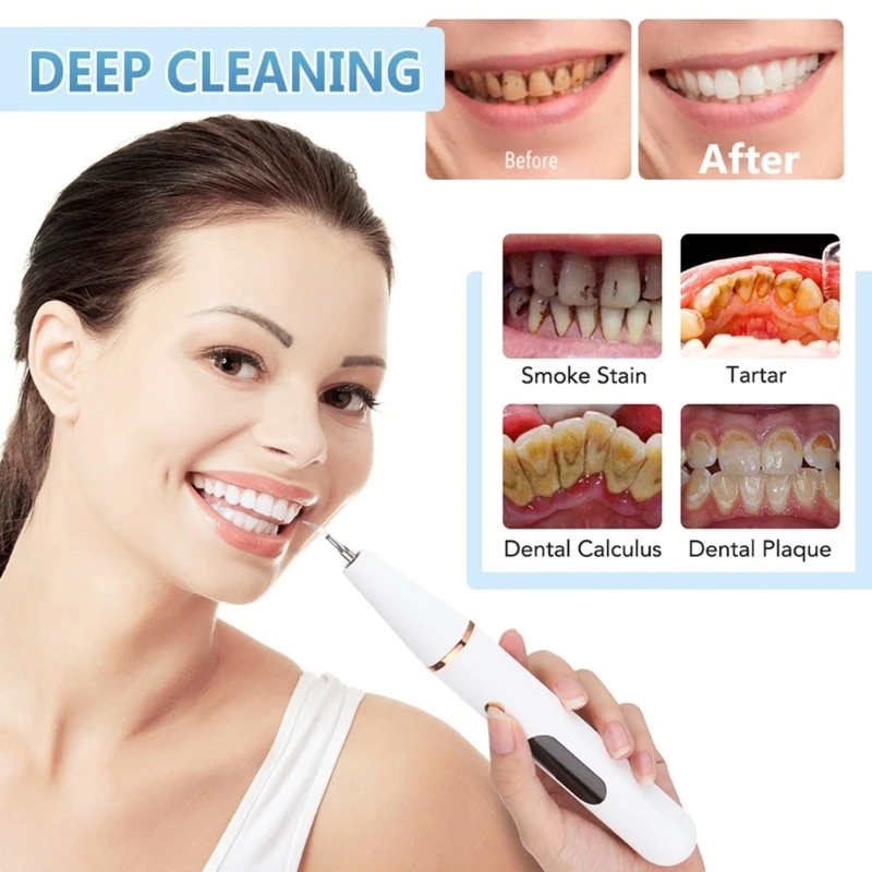 

Plaque Remover for Teeth Stain Remover Ultrasonic Tooth Cleaner K3NE