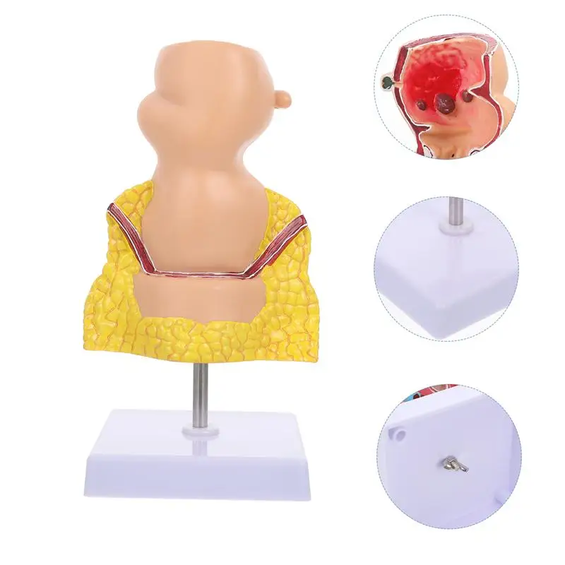 

Медицинский обучающий инструмент для определения заболеваний кишечной железы