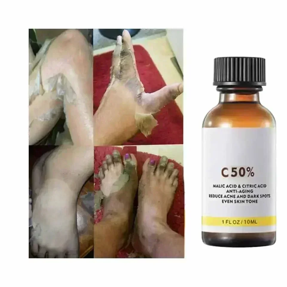 ГОРЯЧАЯ ПРОДАЖА Уход за лицом Отшелушивающий сияющий кожу Выцветание темных