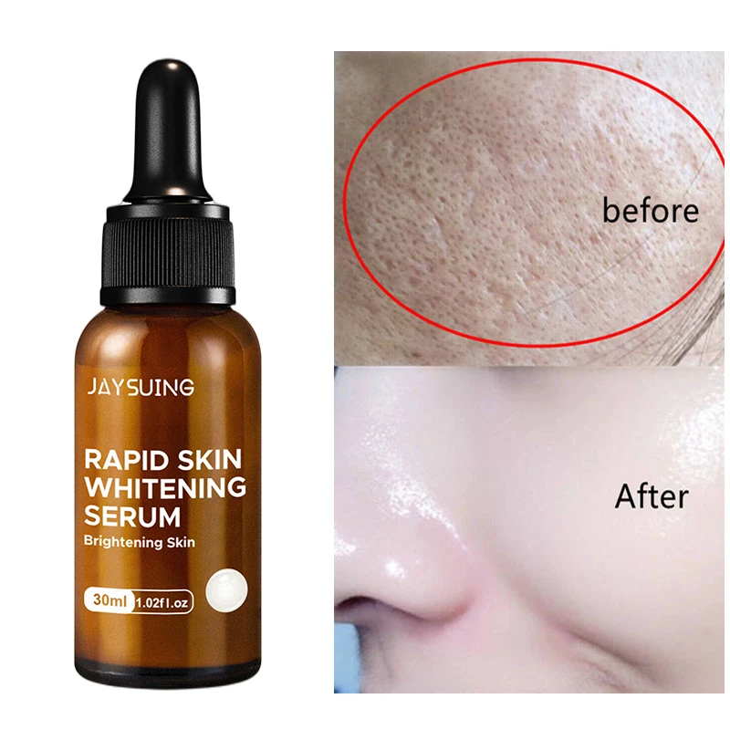 

30Ml Pearl Whitening Serum Nourish Moisturizing Facial Instant Brighten Skin Tone Refine Pore Improve Dull Dry Rough Dark Circle