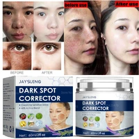 whitening and freckle cream remove melasma dark spots lighten melanin melasma remover moisturizing brightening facial skin care