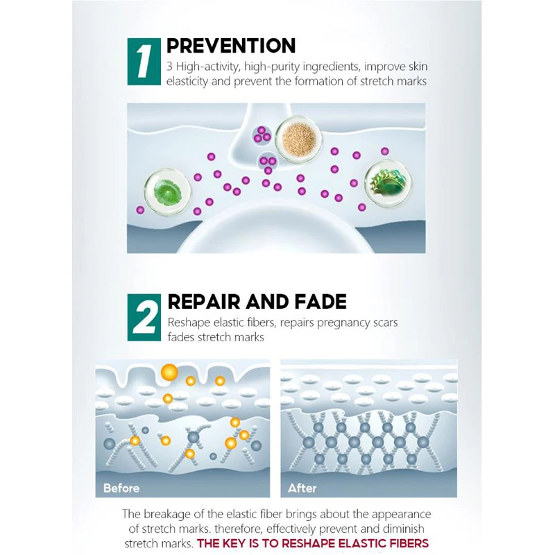 Средство для удаления растяжек, эфирное масло, крем для ухода за кожей ...