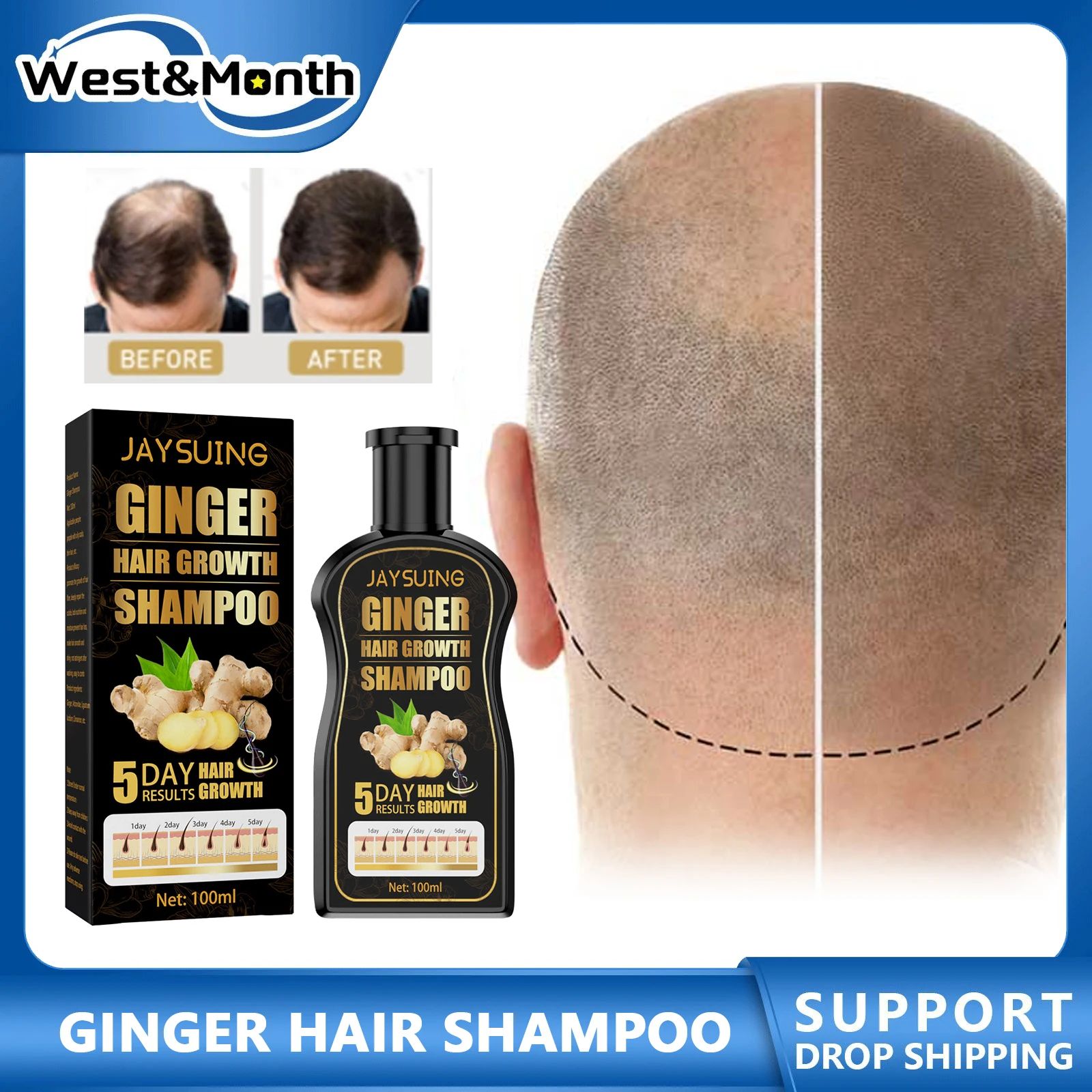 

Ginger Hair Shampoo Anti-hair Loss Treatment Darkening Improve Broken Repair Clogged Follicles Remove Dandruff Oil Nourish Scalp