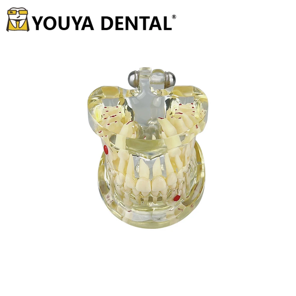 

Transparent Children Pathology Tooth Model For Dental Dentist Student Clinics Dentistry Practice Teaching Training Model