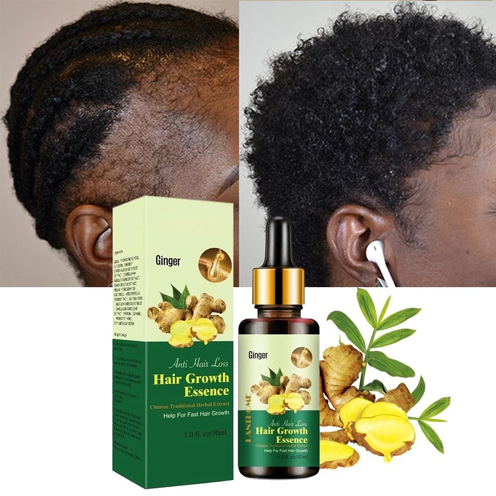 For Fast Hair Growth Prevent Hair Loss Scalp Treatment Hair Growth Product