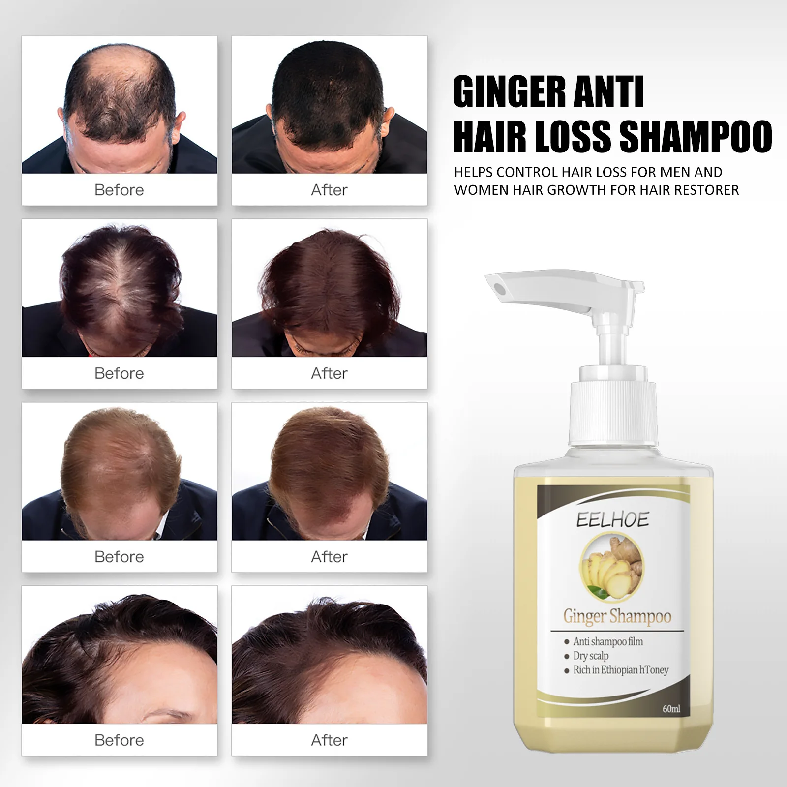 Ginger Hair Loss Prevention Shampoo, Oil Control, Softness, Smoothness, Moisturizing, Root Ginger Juice, Hair Growth Arresting