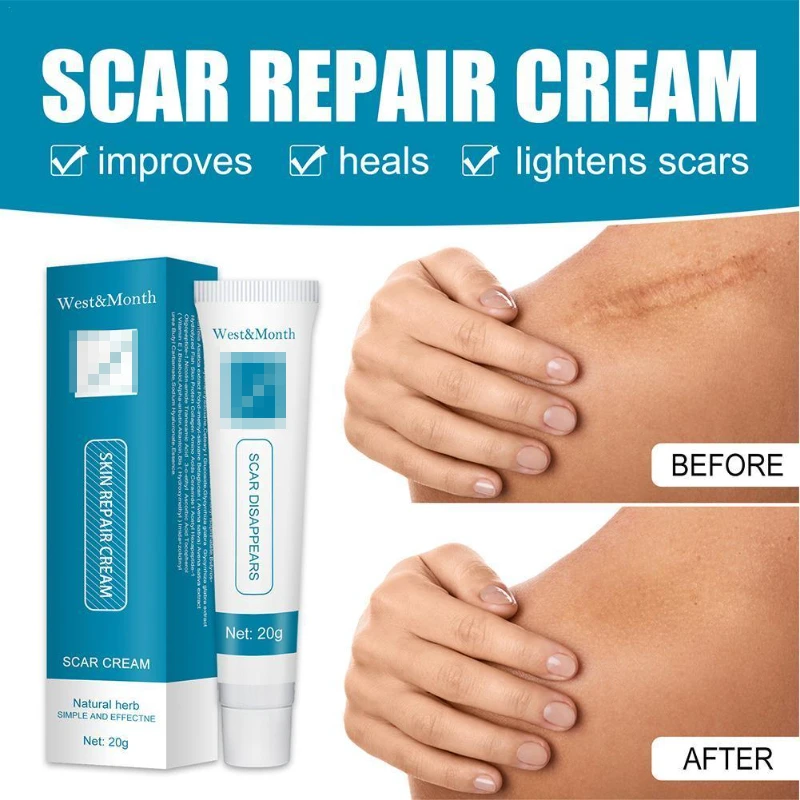 

20g Acne Scar Removal Cream Repair Burn Surgical Scars Stretch Marks Promote Cell Regeneration Repair Treatment Body Skin Care
