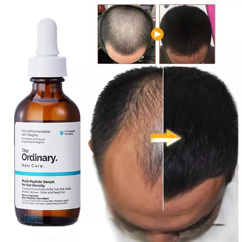 

60ml Ordinary Hair Growth Essential Oil Original Authentic Care Essence Hair Loss Liquid Peptide Treatment Beard Growth Serum