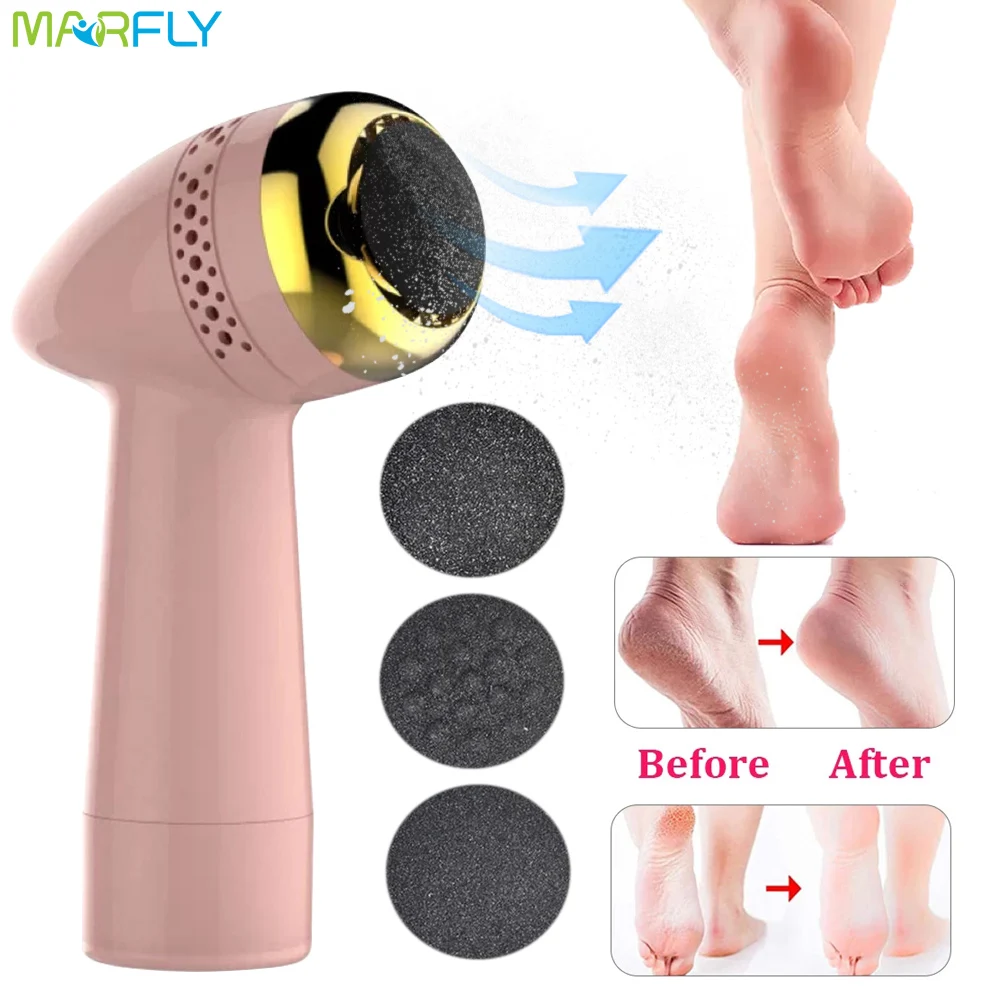 

Electric Foot Files Professional Remove Calluses Peeling Exfoliating Hardness Heels Grinding Pedicure Feet Care Tools Massager