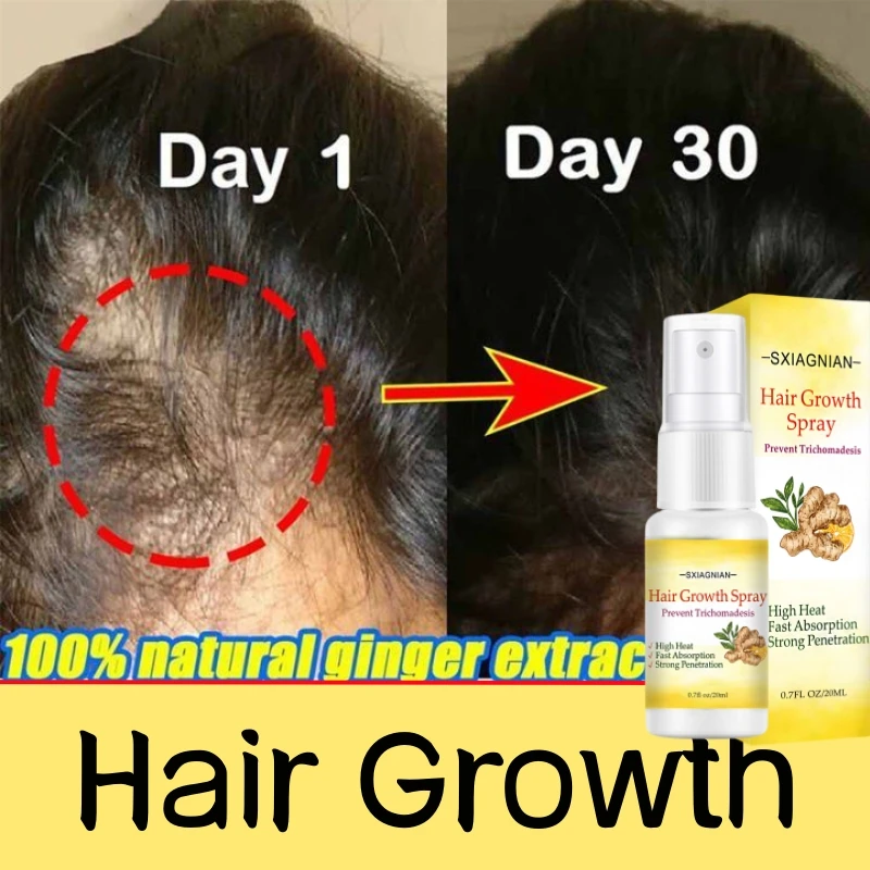 

Ginger Fast Hair Growth Serum Spray Natural Anti Hair Loss Product Prevent Baldness Scalp Damage Treatment Restore Beauty Health