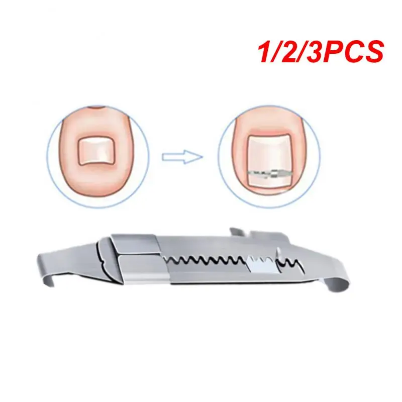 

1/2/3 шт., корректор для вросших ногтей