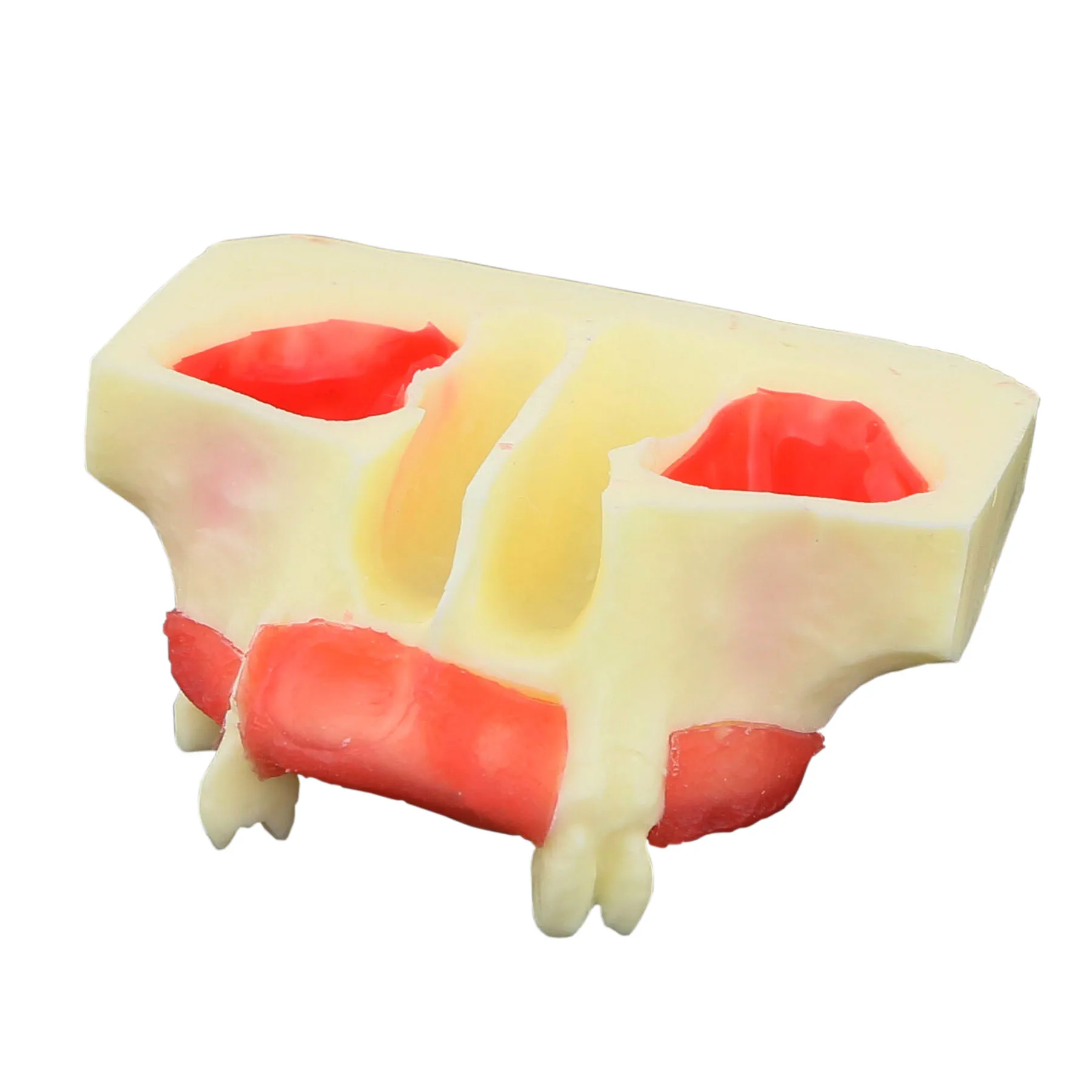 

Dental Implant Teeth Model M2012 Typodont Maxillary Sinus Lift Practice Model Resin Tooth Demo For Teaching Study