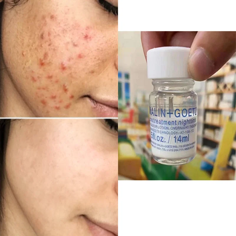 

14ml Marlin Acne Treatment Serum Repair Acne Marks Remove Acne Spots Shrink Pores Repair Whitening Moisturizing Essence