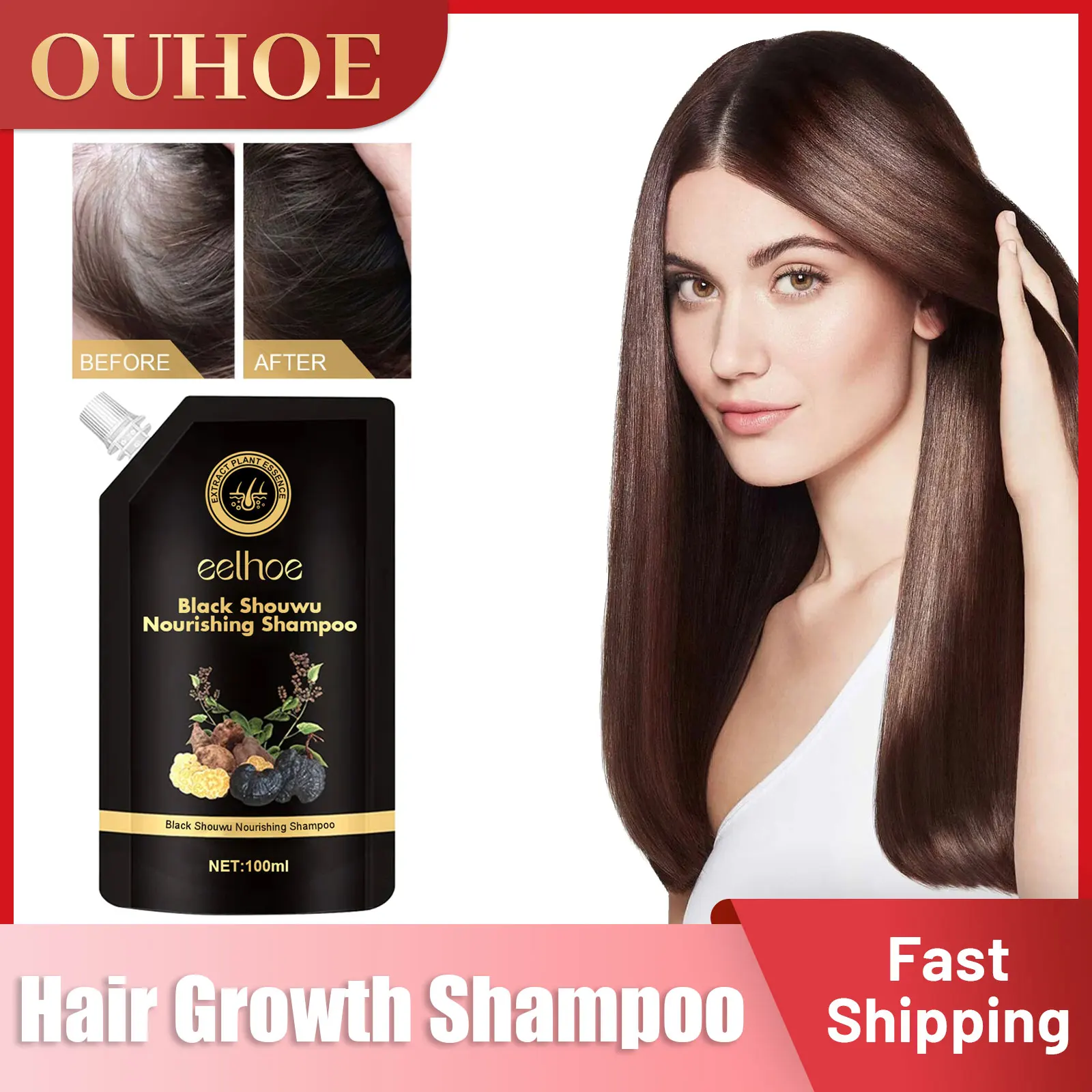 

Hair Growth Shampoo Anti Hair Loss Deep Cleansing Prevent Baldness Oil Control Dandruff Treatment Itchy Relief Hair Care Product