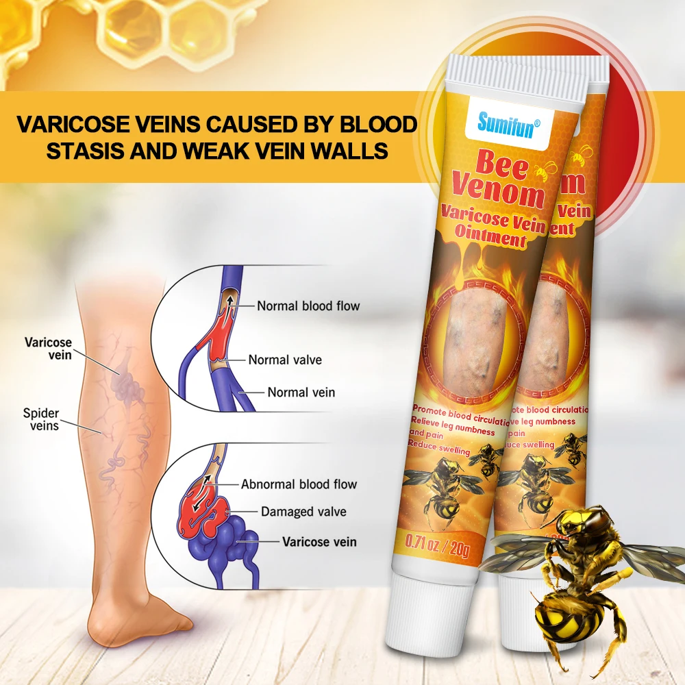1/3/5/10 шт. Sumifun крем от варикозного расширения вен варикозный агирит мазь для