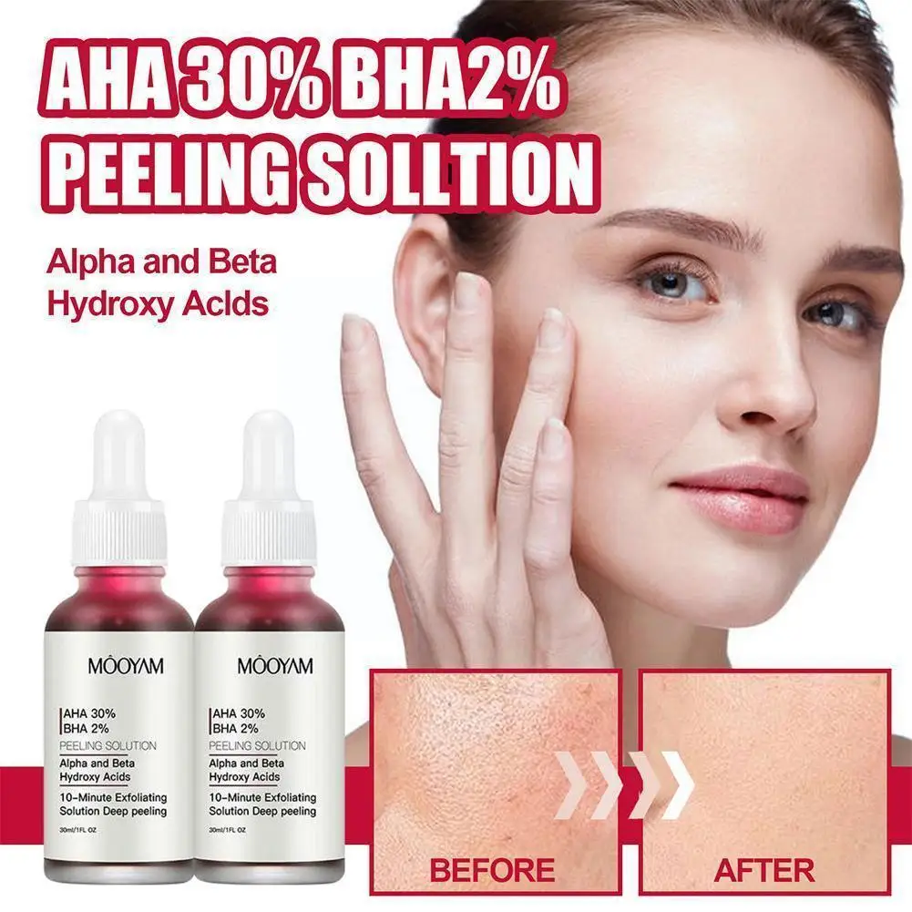

AHA 30% + BHA 2% Fruit Acid Salicylic Acid Essence Shrink Essence Acne Serum Care Pores Exfoliating Blackhead Anti Skin Clo D0O9