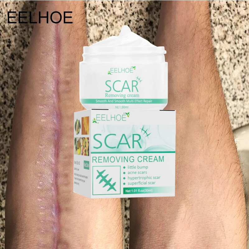 Natural Acne Scar Removal Cream Repair Stretch Marks Promotes Cell Regeneration Moisturizing Repairing Surgical Scar Damage Skin