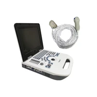sy ax50 full digital led portable ultrasound scanner notebook usg bw ultrasound machine