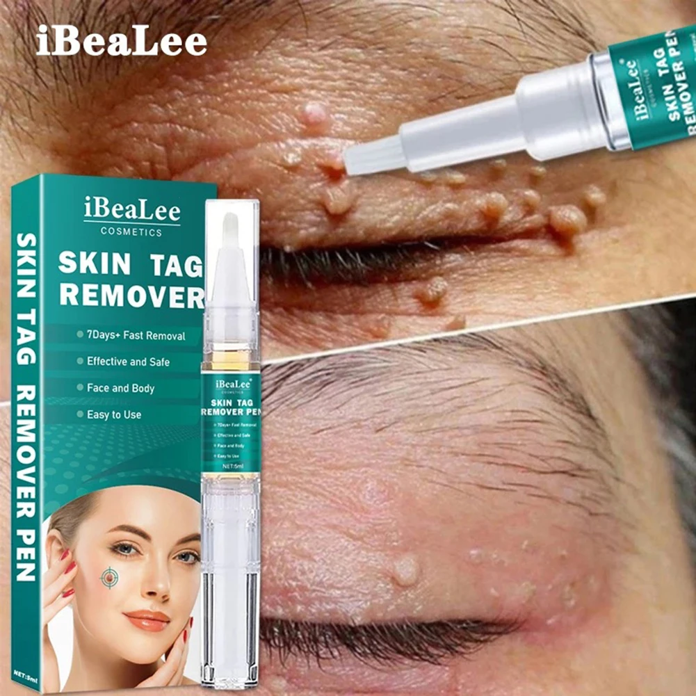 

Skin Tag Remover Pen Beauty Face Cream Natural Ingredients Dark Spot Mole Removal Serum Painless Warts Removing Essential Oil