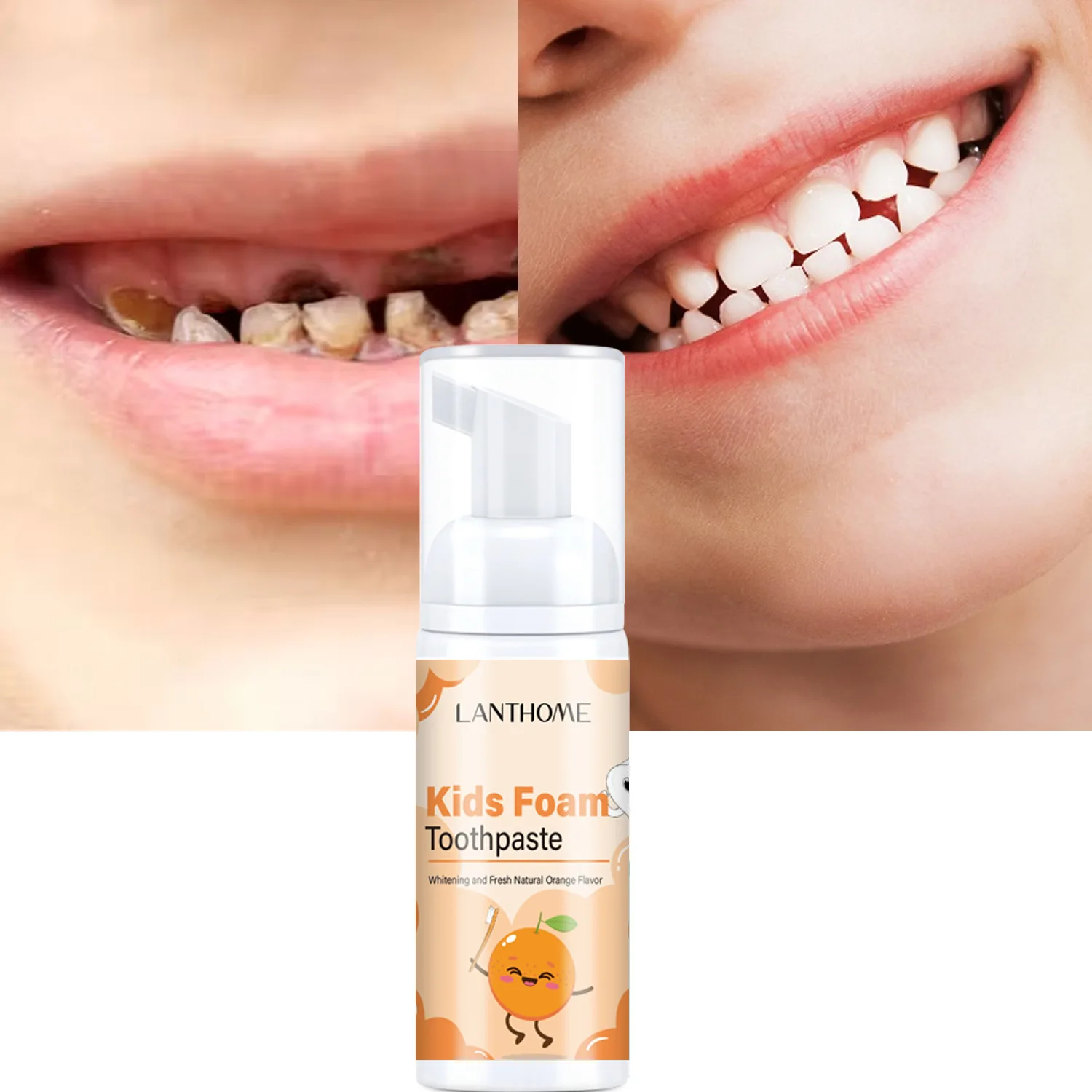 

Sdotter Kids Foam Toothpaste Stain Removal Whitening Tooth Anti-cavity Oral Cleaning Fruit Flavor Mousse Toothpaste Daily Teeth