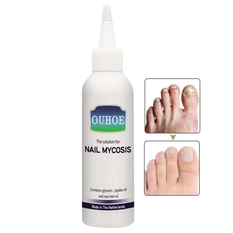 

Nail Cuticle Oil 75ml Professional Nail Treatments Hardener Liquid Cuticle Oil For Soft Peeling Nails Painless Nail Repair