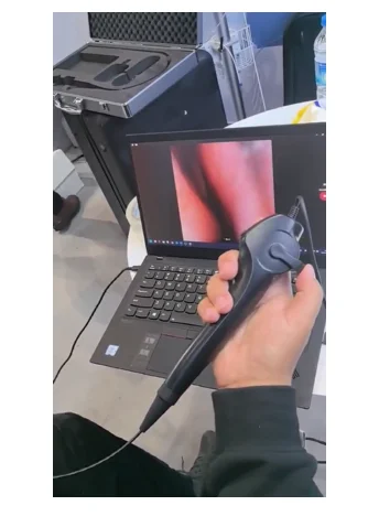 

Besdata ЛОР Назальный прицел CMOS