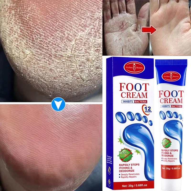 

Herbal Anti Crack Foot Hand Cream Anti-Drying Heel Cracked Repair Removal Dead Skin Calluses Whitening Moisturizing Skin Care