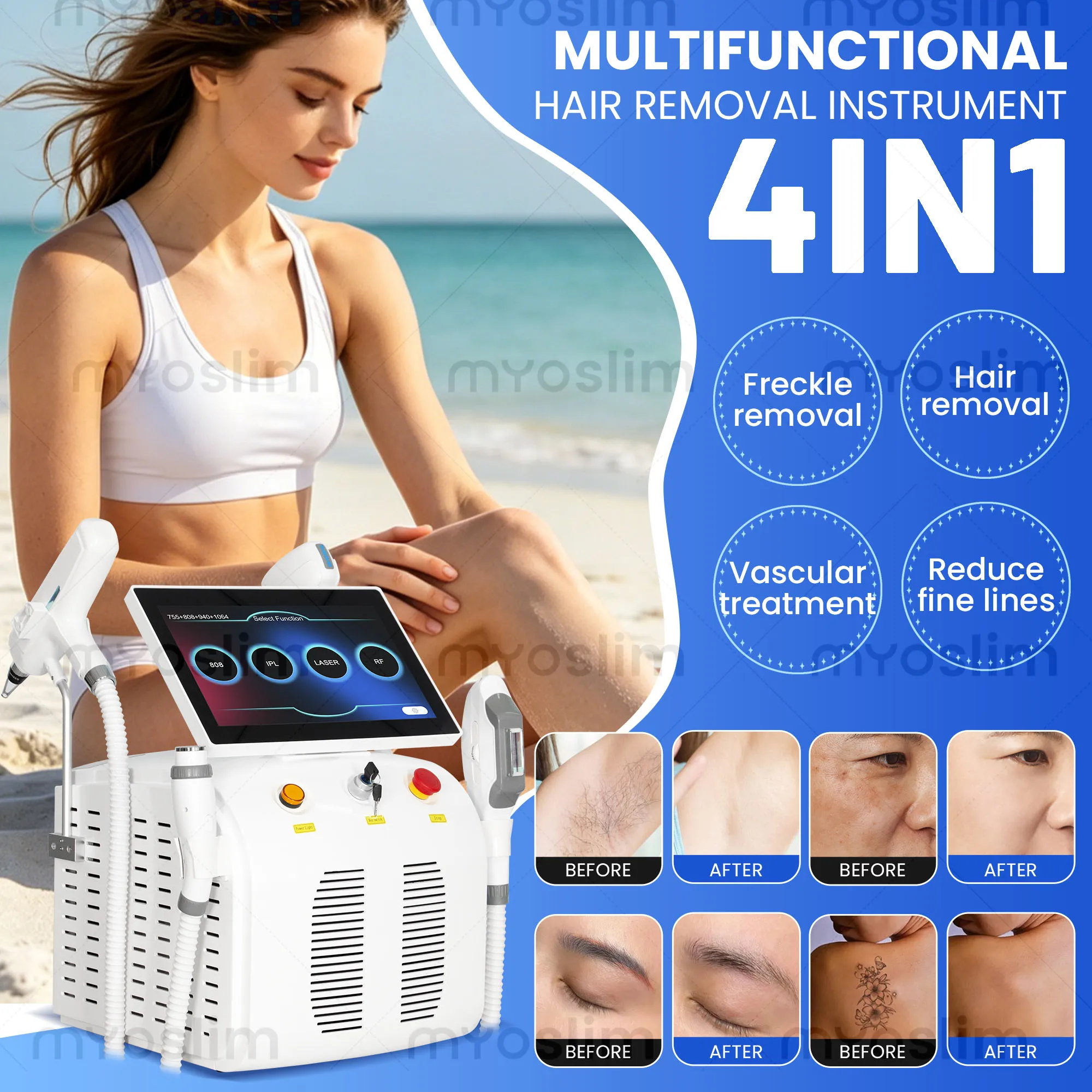 Фото Многофункциональный аппарат 4-в-1 Soprano Titanium Ice Platinum RF Pico IPL Diode 4-Wave 755 808 940 1064 RF IPL ND:YAG для безболезненного удаления волос №2