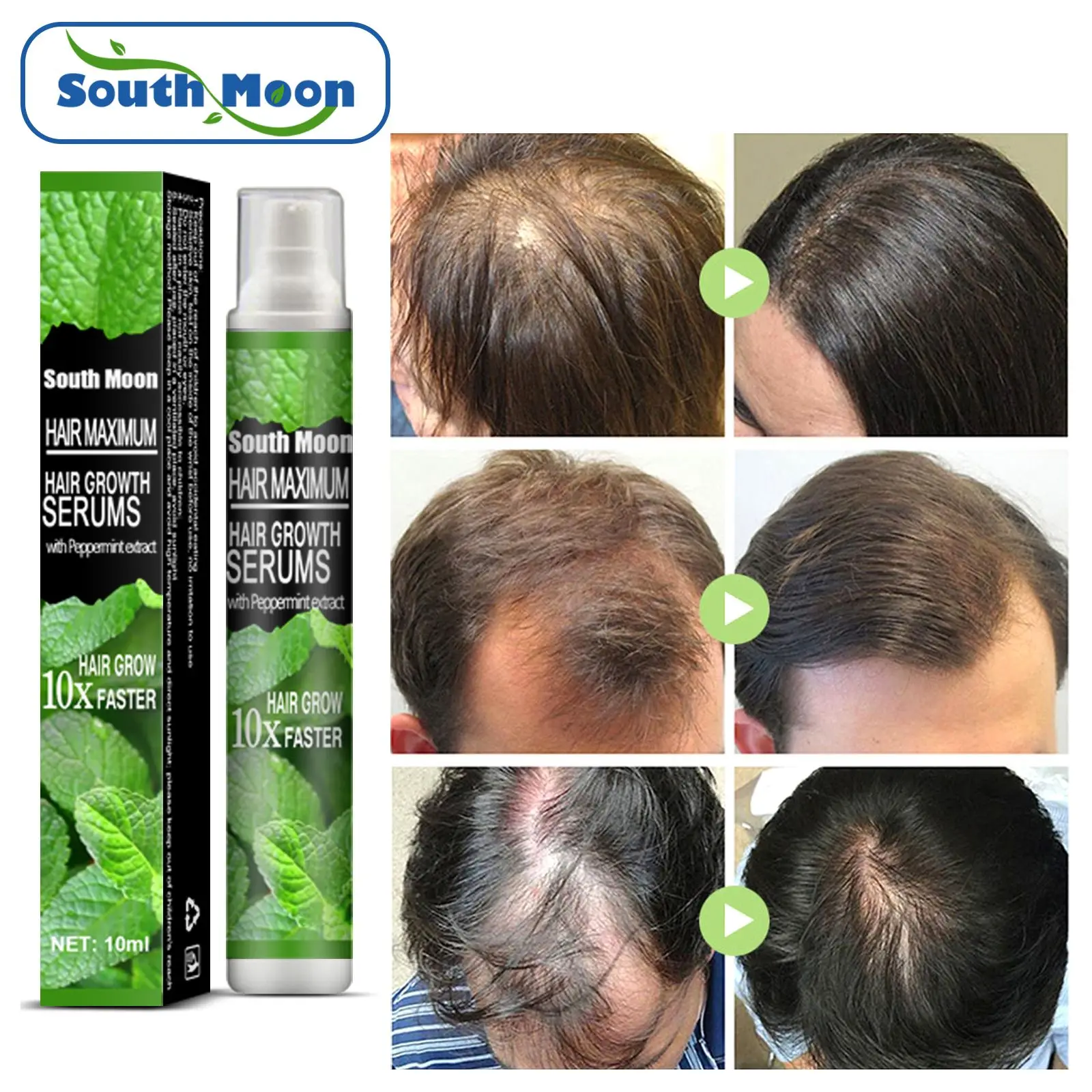 

Haircare Baldness Repair Germinal Hair Regrowth Spray With Peppermint Extract Treatment Serum Hair Root Nutrients