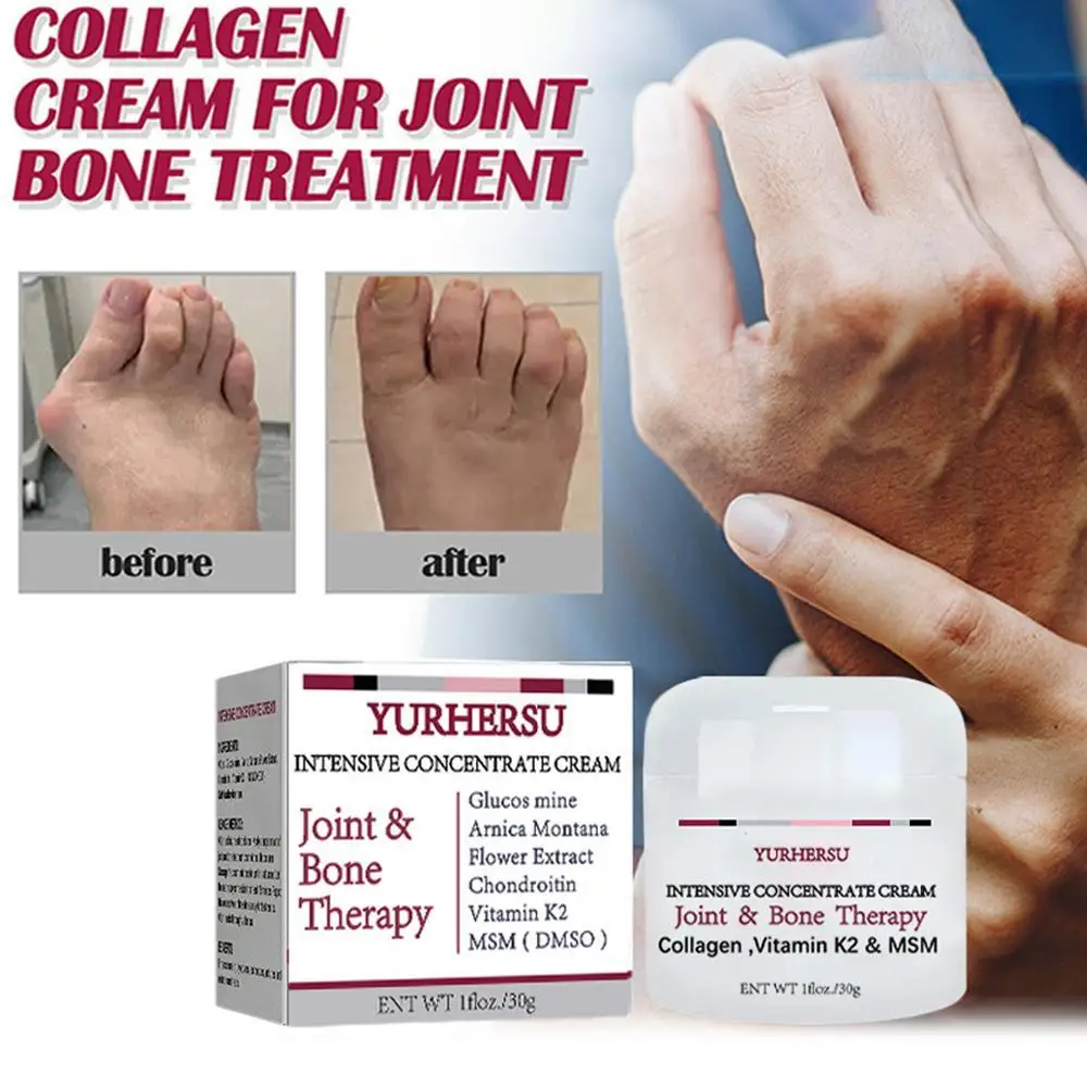 

30g Joint Bone Treatments Cream Joint Massage Bone Treatments Collagen Cream Effective Relieve Joint Body Pain Health Care