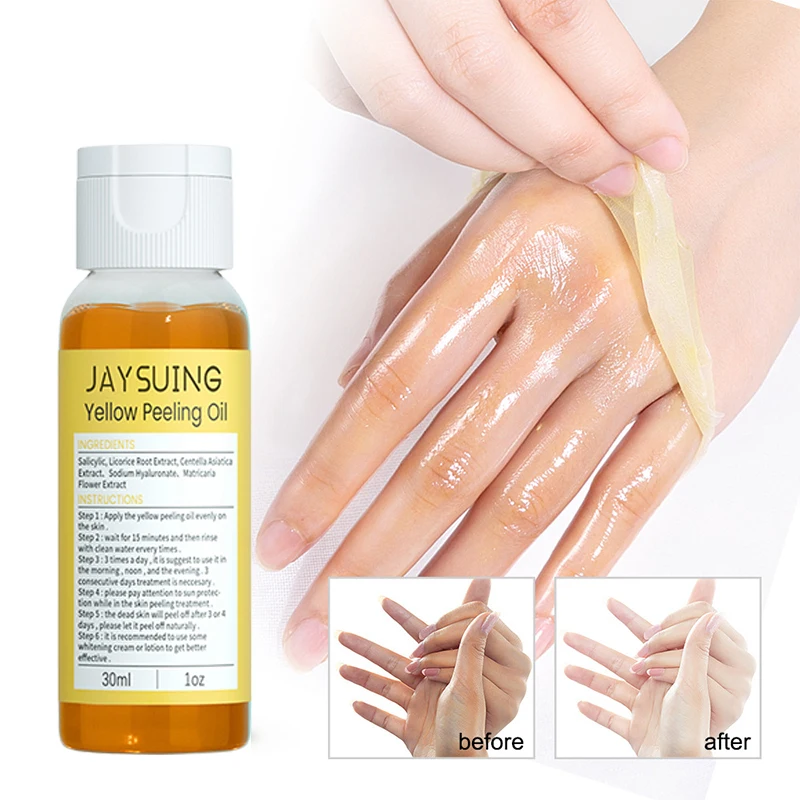 

Yellow Peeling Oil Fade Melanin Skin Bleaching Arm Knee Legs Whitening Brighten Skin Tone Serum Scrub Exfoliating Dead Skin Care