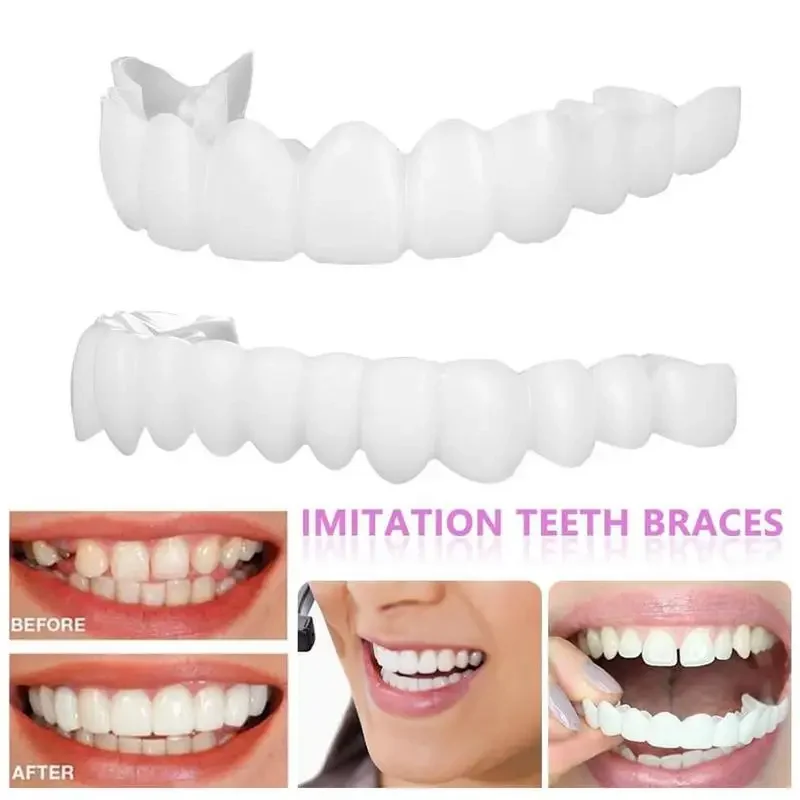 Новый Sdottor Snap On Teeth Veneers Зубные протезы для мужчин и женщин Покрытие зубов