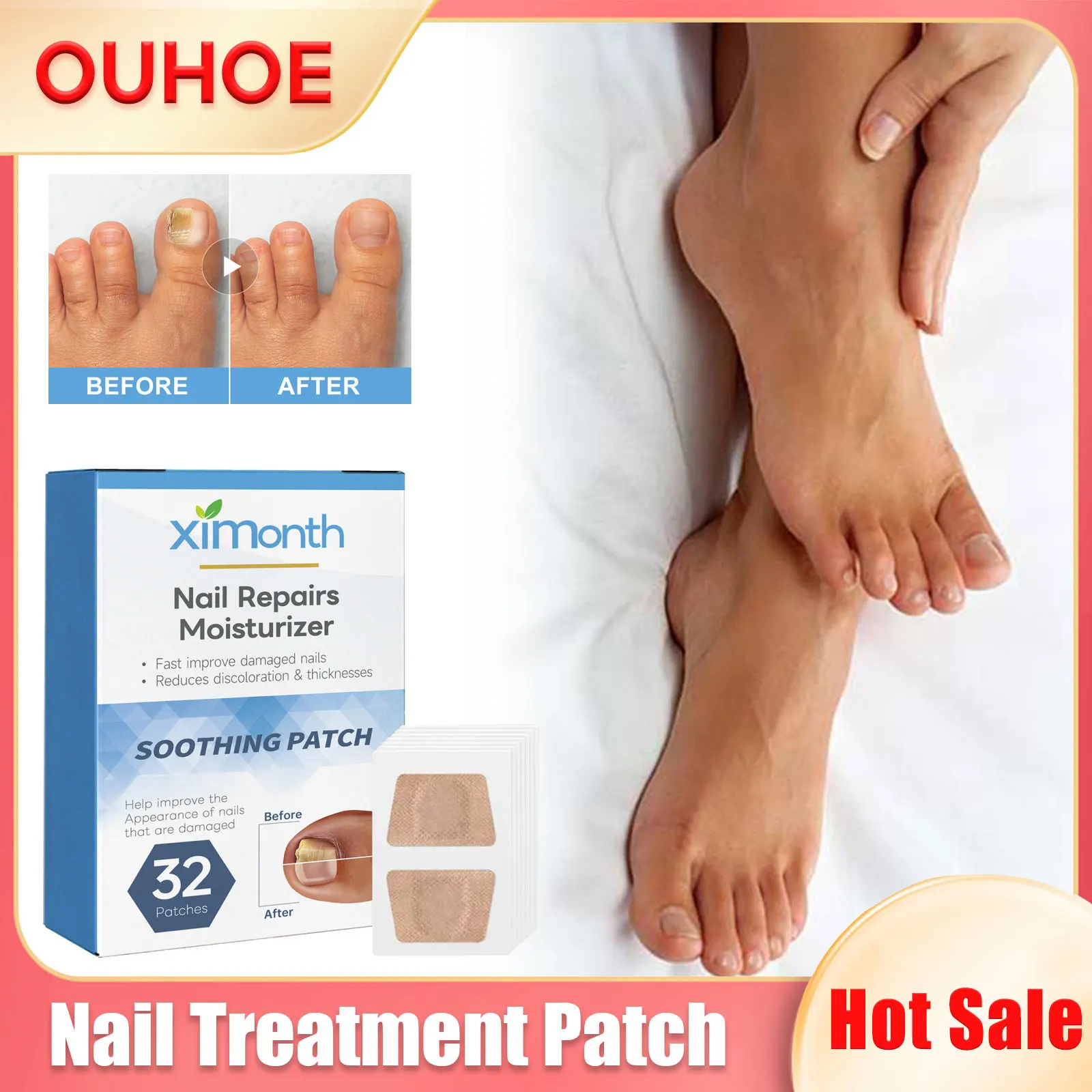 

Nail Treatment Patch Paronychia Relief Anti Infection Fungal Onychomycosis Repair Stop Pain Ingrown Toenail Correction Sticker