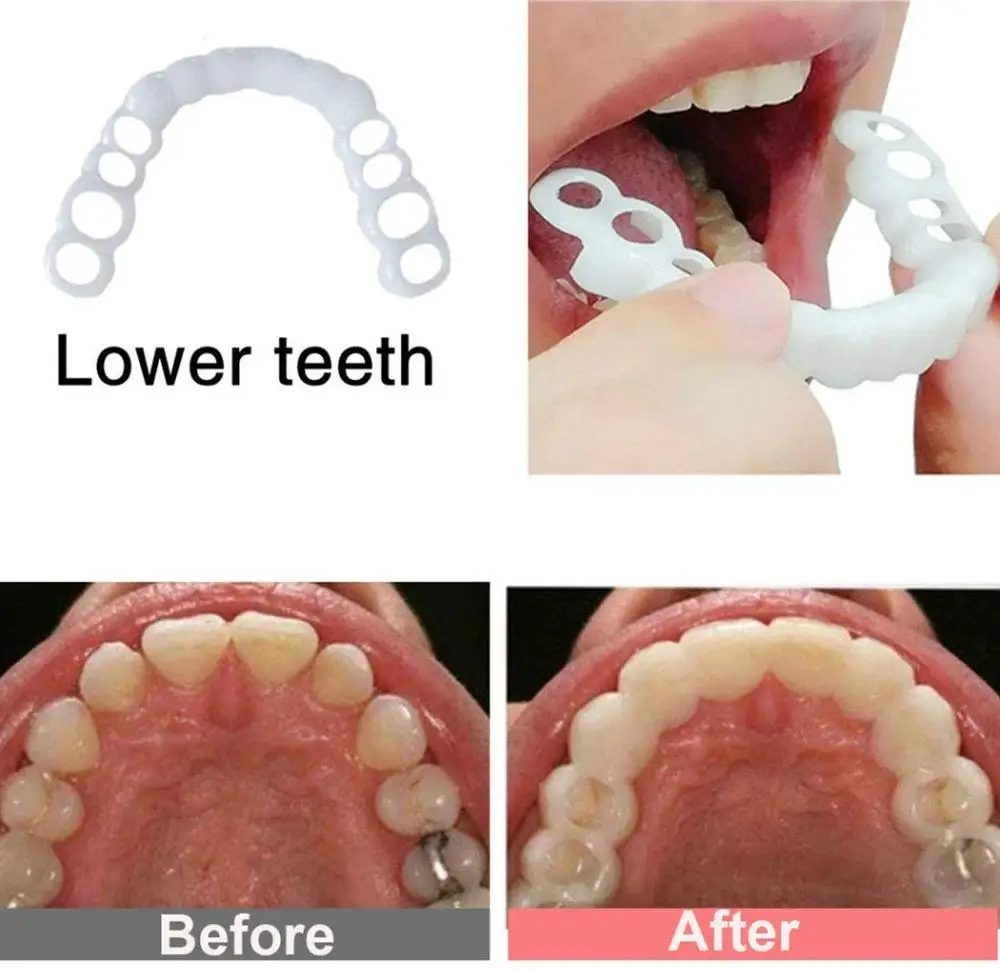 

1 set Perfect Fit Teeth Whitening Fake Tooth Cover Snap On Silicone Smile Veneers Teeth Upper Beauty Tool Cosmetic Teeth