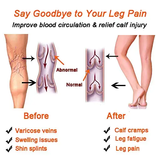 1 пара компрессионные носки для мужчин и женщин предотвращения варикозного