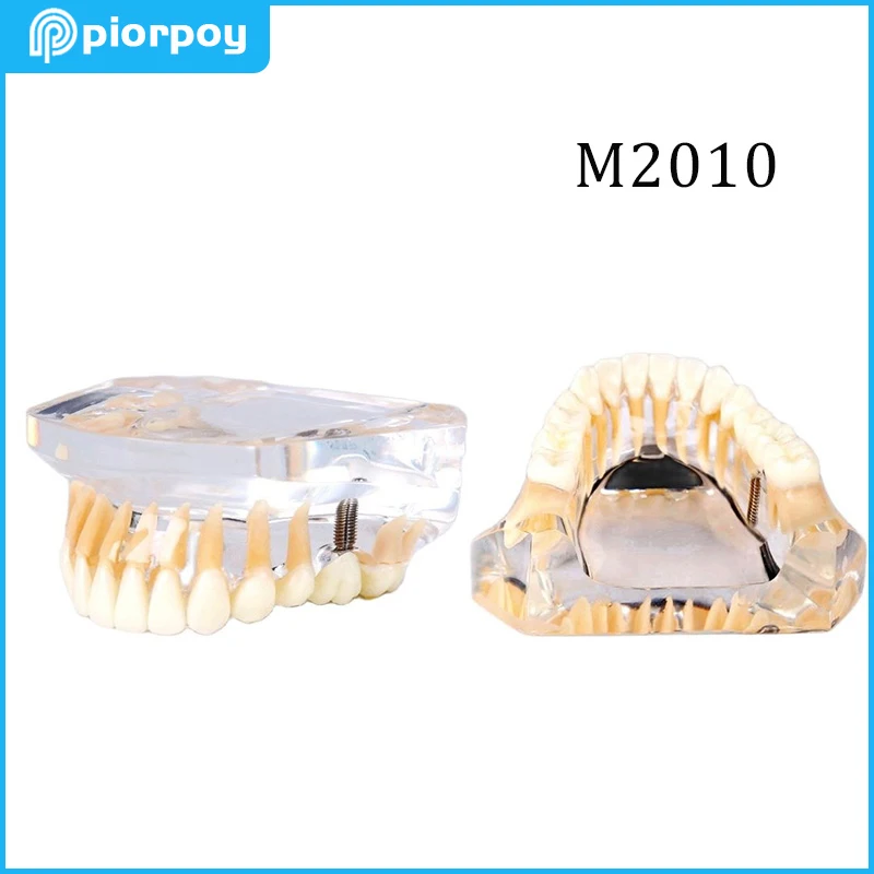 стоматология имплант 52. карта стоматолога имплантолога. профессиональный стоматолог. имплантация нижний новгород отзывы. изумрудная 52 стоматология.