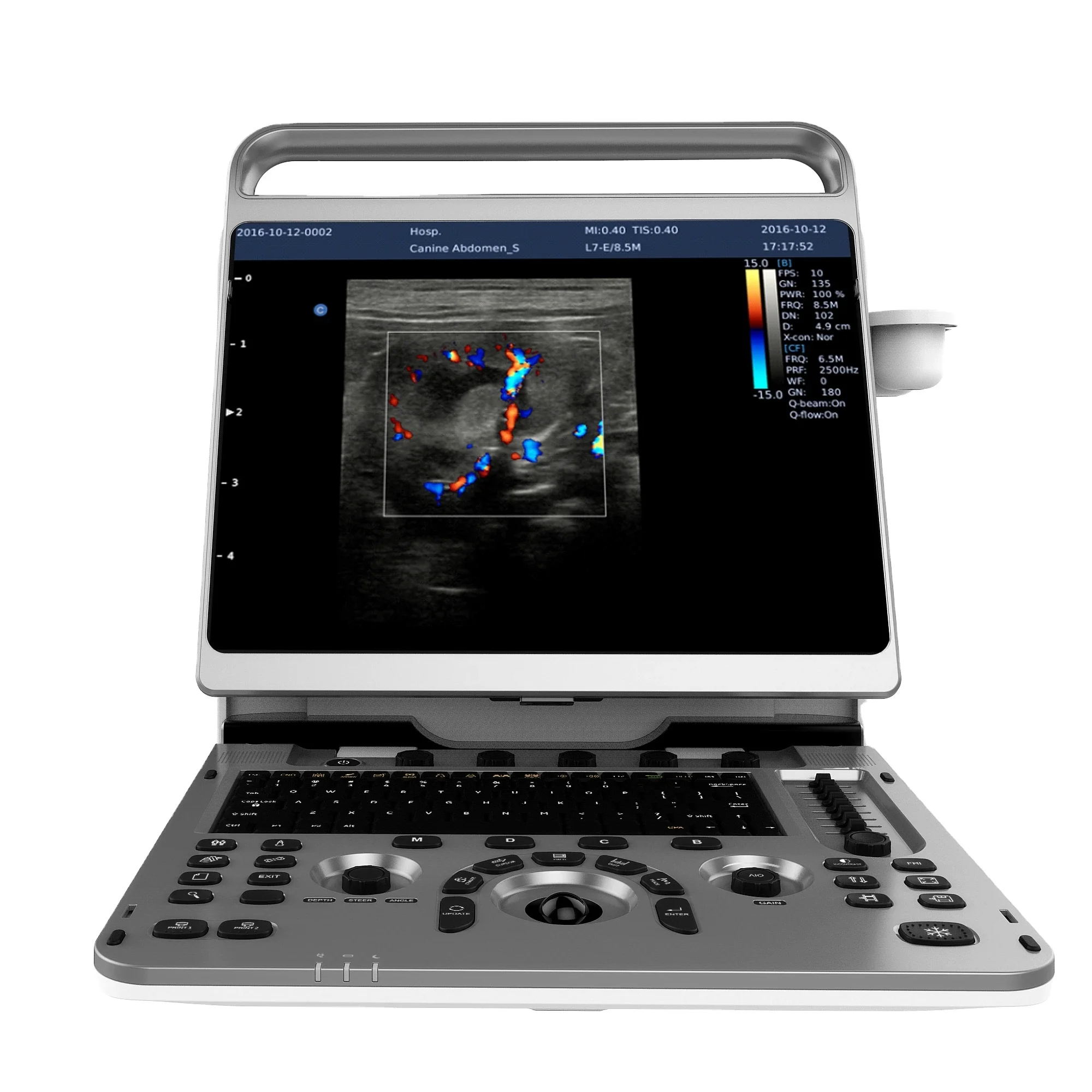 Ebit30 4D 5D Portable Color Doppler Human Ultrasound Gynecology,Cardiovascular Echo machine