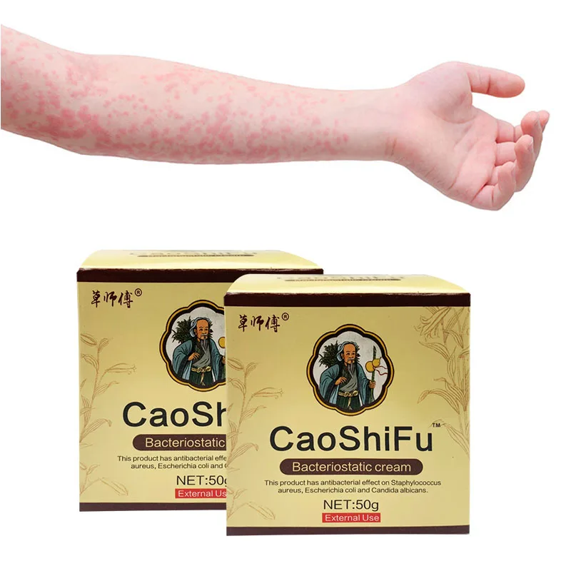 

2Pcs ZB Professional Psoriasis Dermatitis Treatment Ointment Skin Rash Urticaria Desquamation Antibacterial Eczema Cream