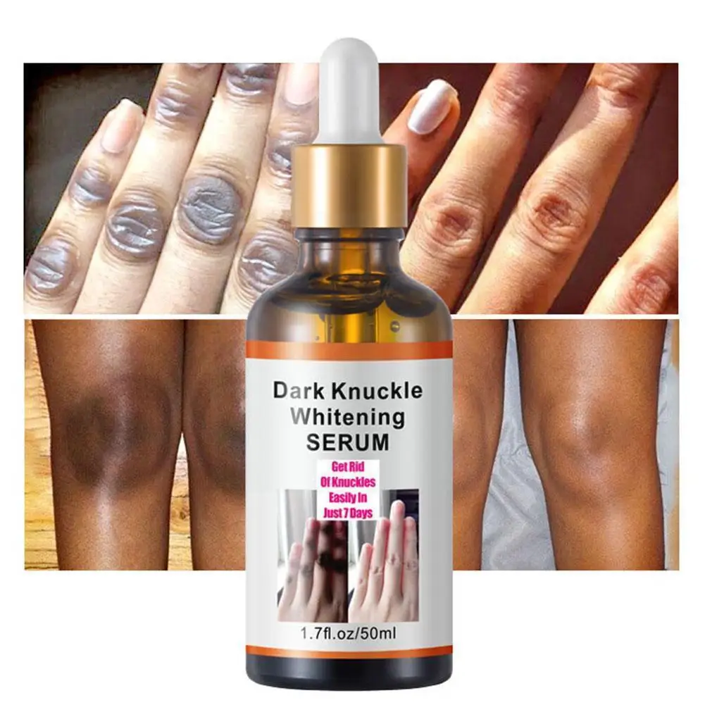 

Hand & Finger Joint Brightening Serum 50ml Whitening Removing Dark Knuckles Serum Hand Knuckle Eraser Serum For Elbow And K X0o2