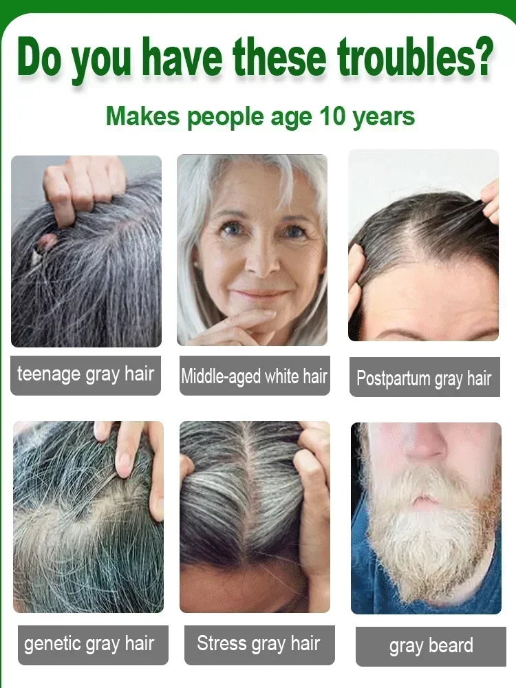 Anti Gray Hair Permanent Serum White hair treatment essence quickly turns white into black natural color Products