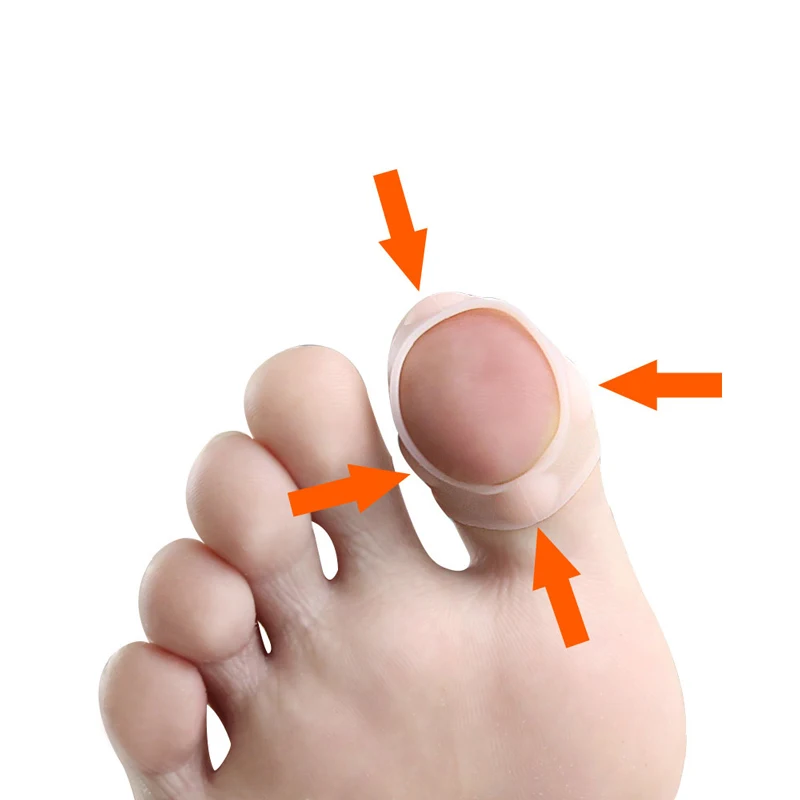 Ingrown Toenail Corrector Silicone Toe Separator Straightener Orthopedic Bunion Protector Foot Care Tools Heel |