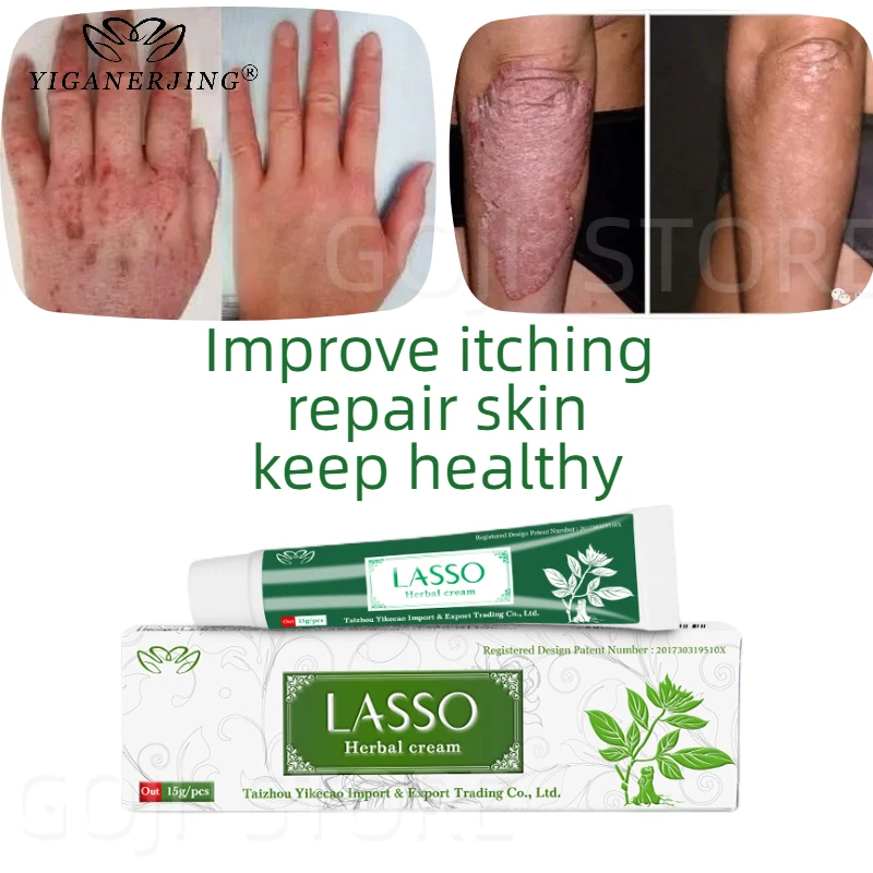 

YIGANERJING Lasso Natural Skin Care Cream Dermatitis Eczematoid Eczemas Ointments Psoriasis Treatment Medical Health Care Cream