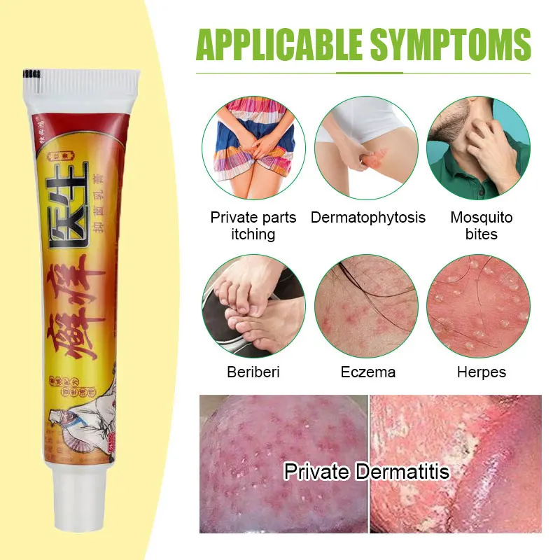 

Chinese Herb Medical Health Skin Care Products Effective Anti-Itch Dermatitis Eczematoid Ointment Psoriasis Antibacterial Cream