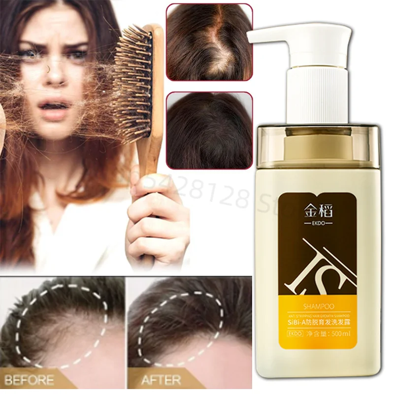 

Natural Herb Anti-stripping Hair Care Shampoo Improves Mia Anti-stripping Hair Fixing Oil Control Soft Shampoo Anti-thinning