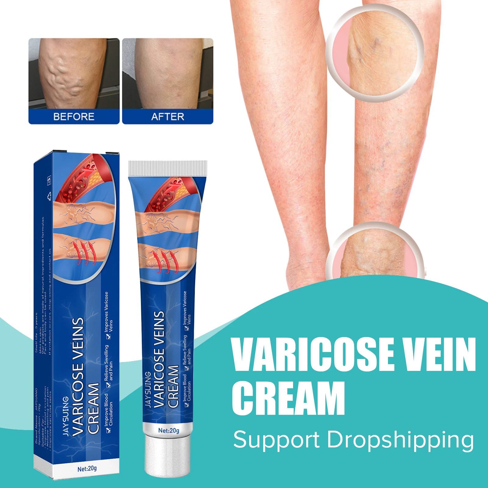 

Vein Cream Treatment Spider Angiitis Vasculitis Relief Leg Phlebitis Blood Swelling Effective Pain Massage Varicose Ointment 20g