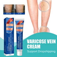 vein cream treatment spider angiitis vasculitis relief leg phlebitis blood swelling effective pain massage varicose ointment 20g